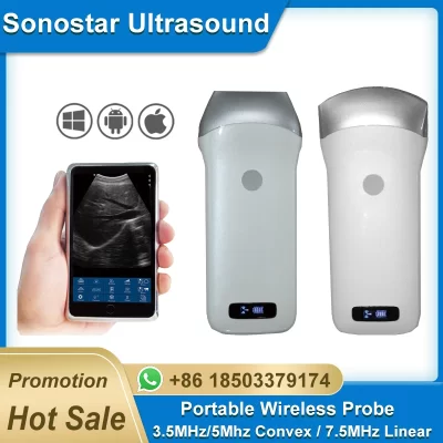 Sonda de ultrassom sem fio portátil, Sonda WiFi, Convexa, Linear, Suporte ISO, Andriod, Wi-Fi-Scanner, 3,5Hz, 7,5 MHz