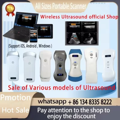 Sonostar marca fábrica portátil sem fio ultrassom sonda scanner máquina portátil wifi ultrassom scanner suporte oem