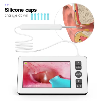 Otoscópio digital com giroscópio, câmera de escopo de ouvido de 3,5 mm com 6 luzes 1080P 4,3 polegadas IPS Ferramenta de remoção de cera de ouvido para crianças e adultos