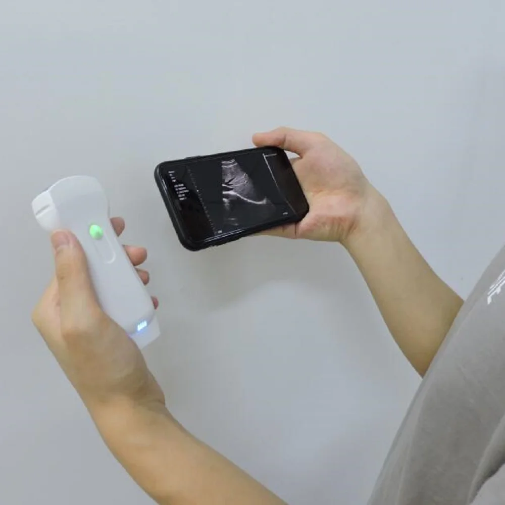 Sonda de ultrassom sem fio para android ios apple google play sistemas windows 3-em-1 cabeças duplas 128 elementos sonda doppler colorida - Image 5