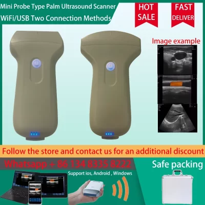 Ultrassom sem fio portátil wifi/usb conexão scanner 96e sonda máquina cor linear/convexo doppler sonostar marca fábrica