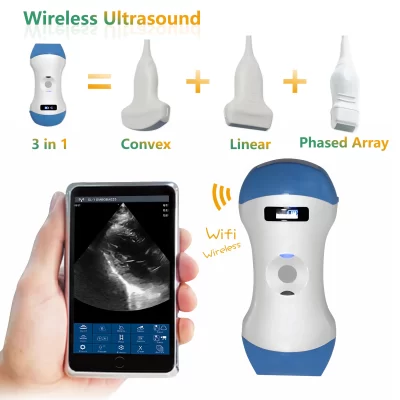 Scanner de sonda de ultrassom sem fio ultrassom doppler de palma Convex/Linear/Phased array suporte três em um iOS Android Windows