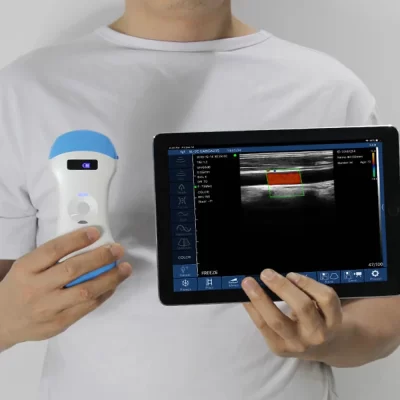 WiFi sem fio cor ultra-som Doppler, 3 em 1 sonda, convexa linear faseada, array sonda, 128E