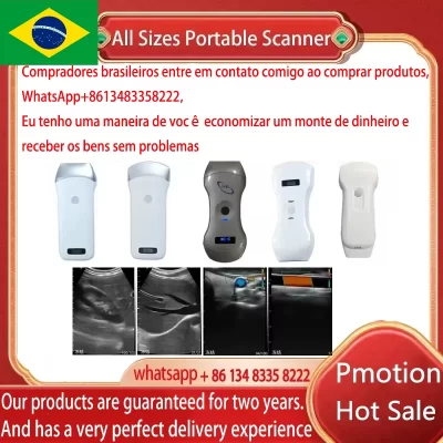 Mala grátis portátil sem fio ultrassom sonda scanner máquina portátil wifi ultrassom scanner máquina sonostar marca fábrica