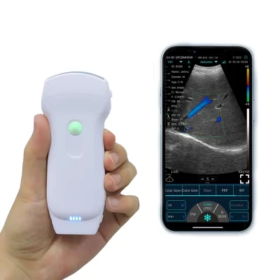 Sonda de ultrassom sem fio para android ios apple google play sistemas windows 3-em-1 cabeças duplas 128 elementos sonda doppler colorida