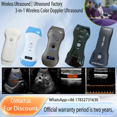 Portátil sem fio 3in1 cor doppler scanner de ultrassom wifi ultrassom sonostar fábrica loja suporte ios android windows