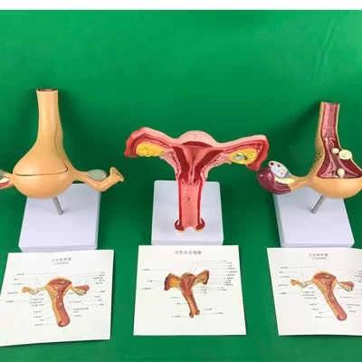 Ovário e Dissecção Uterina Modelo, Patologia Feminina Ensino, Modelo Ensino, Ensino Humano, Anatomia Uterecare