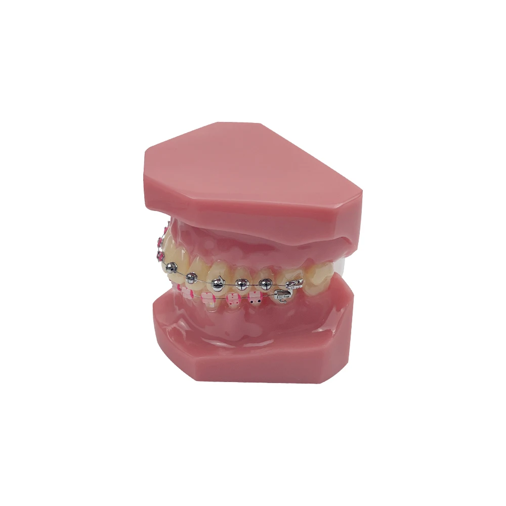 Modelo ortodôntico de dentes dentários com suportes 1/4 esférico auto-travamento para ensino, estudo, dentista, educação de pacientes