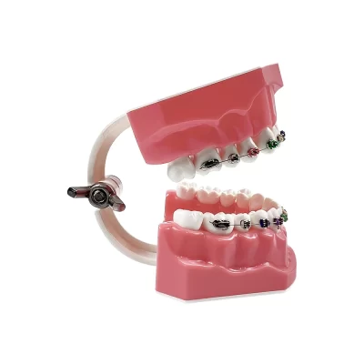 Modelo de dentes ortodônticos com suporte de metal completo, novo modelo de tratamento ortodôntico dentário, modelo de mandíbula Typondont para ensino de demonstração