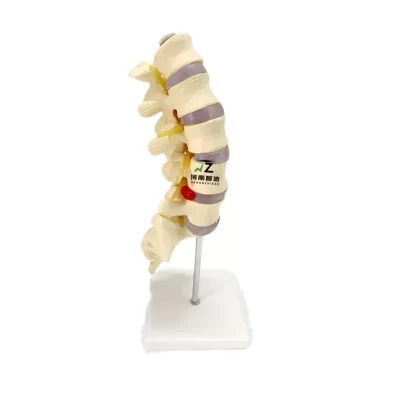 Vertebra lombar da coluna humana de alta qualidade 1:1 modelo de esqueleto humano conjunto de simulação de esqueleto modelo removível