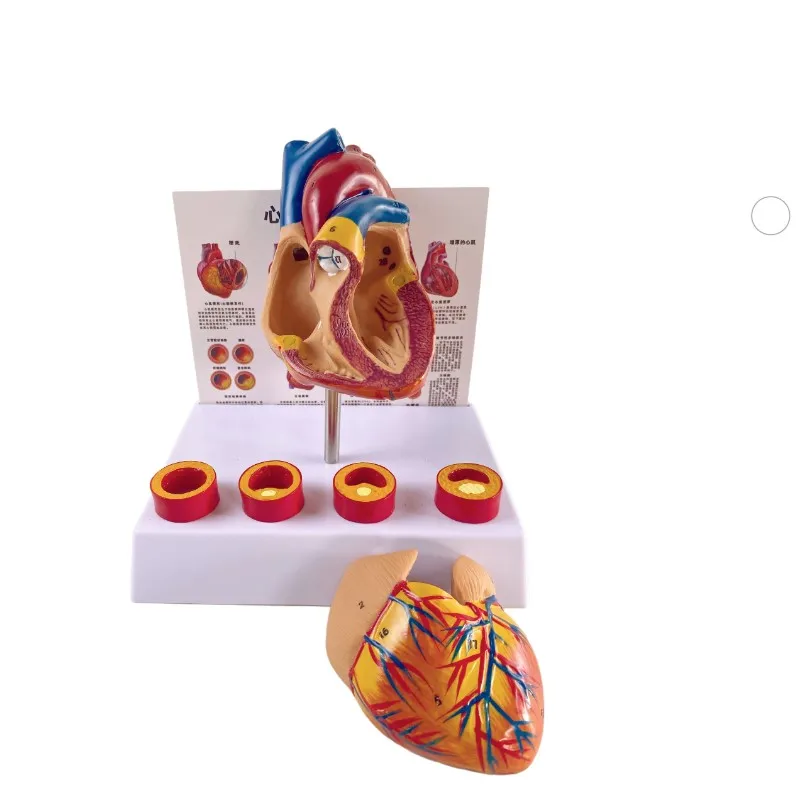Modelo anatômico do coração vascular do tamanho da vida, Anatomia removível Modelo vascular trombótico do coração, Coração médico, 18x14x23cm - Image 2