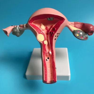 Novo modelo de ovário de útero patológico humano, estrutura de seção transversal, modelo de útero, anatomia anatômica, órgão feminino, ferramenta de estudo de ensino