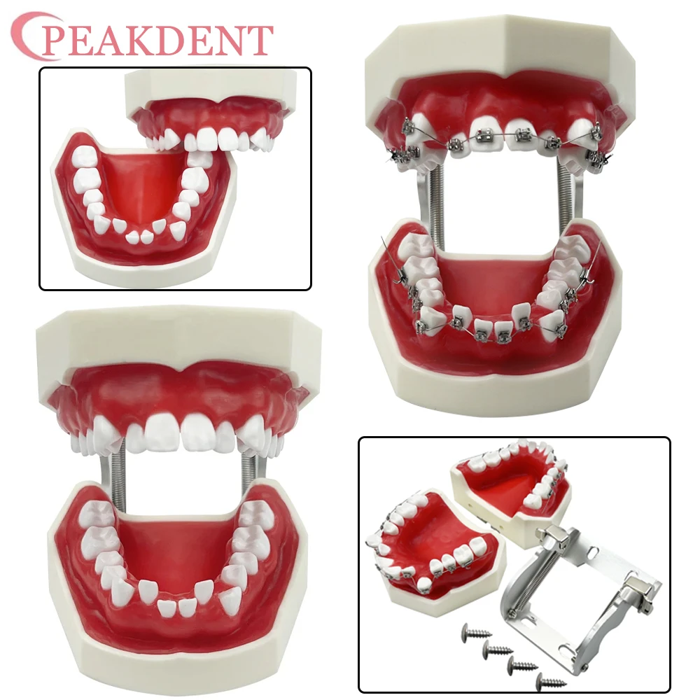 Modelo dental com suporte ortodôntico removível modelo de ensino dental tipodonte com cera vermelha para estudo de ensino de pacientes dentistas - Image 2