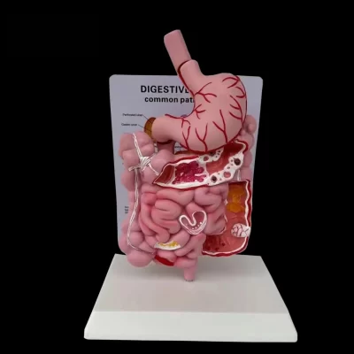 Modelo de sistema digestivo humano, anatomia do estômago, intestino grosso, cecum, reto, duodeno, órgãos internos humanos, modelo de estrutura ﻿