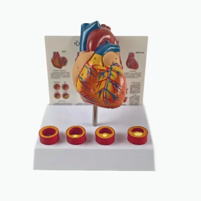 Modelo anatômico do coração vascular do tamanho da vida, Anatomia removível Modelo vascular trombótico do coração, Coração médico, 18x14x23cm
