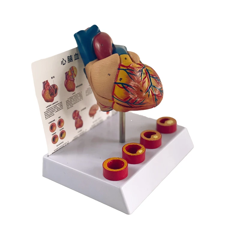 Modelo anatômico do coração vascular do tamanho da vida, Anatomia removível Modelo vascular trombótico do coração, Coração médico, 18x14x23cm - Image 3