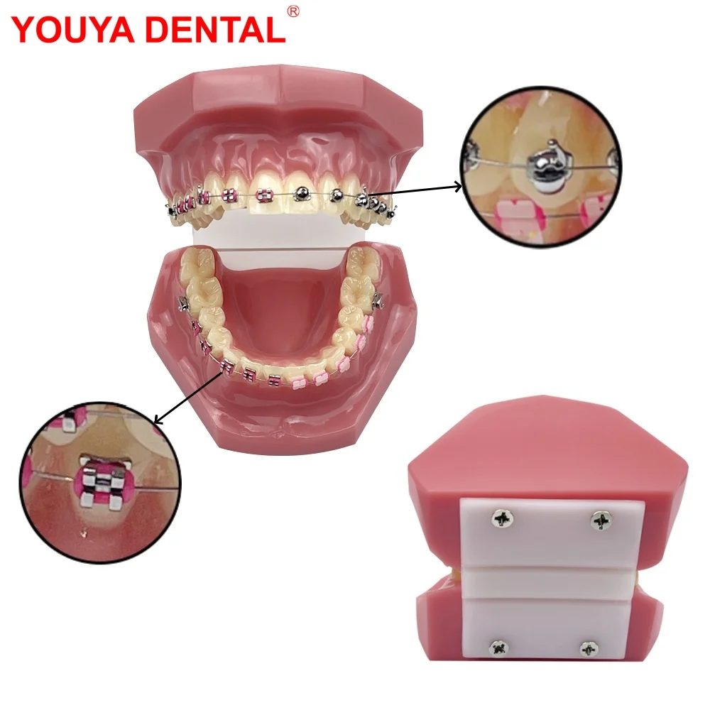 Modelo ortodôntico de dentes dentários com suportes 1/4 esférico auto-travamento para ensino, estudo, dentista, educação de pacientes - Image 2