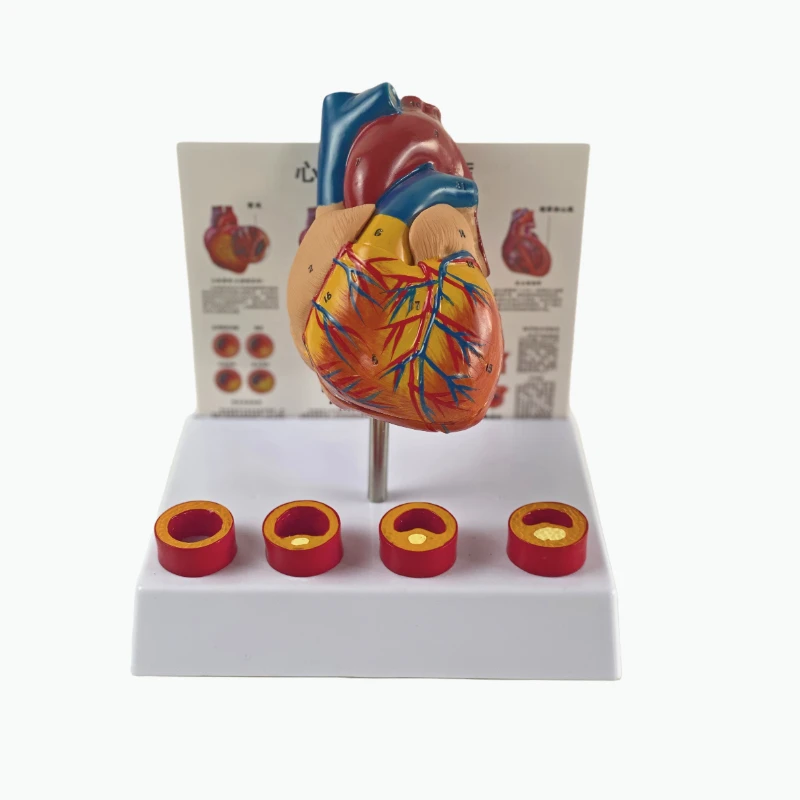 Modelo anatômico do coração vascular do tamanho da vida, Anatomia removível Modelo vascular trombótico do coração, Coração médico, 18x14x23cm - Image 4