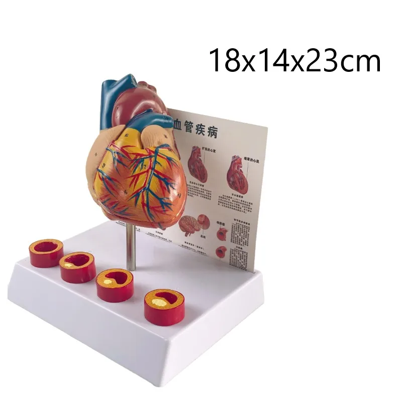 Modelo anatômico do coração vascular do tamanho da vida, Anatomia removível Modelo vascular trombótico do coração, Coração médico, 18x14x23cm - Image 5