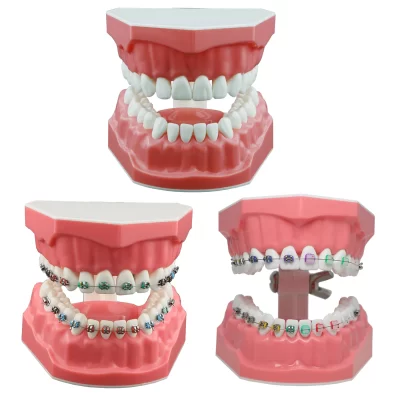 Modelo de dentes dentários tipodont ortodôntico com fio de metal suportes claros para adultos crianças ensino estudo escovação prática padrão