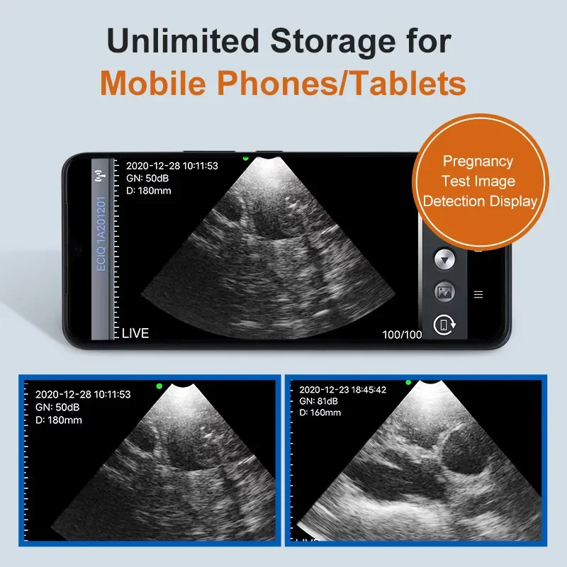 Scanner de ultrassom veterinário portátil sem fio para porcos, cães, ovelhas, sonda ip67, scanner de ultrassom portátil, detecção de gravidez - Image 5