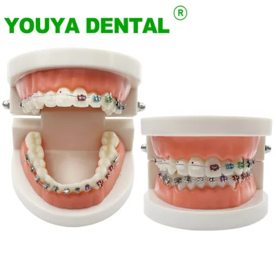 Modelo de dentes ortodônticos com suporte de metal autoligado, aparelho de cerâmica, ferramentas de demonstração tipodonte para comunicação de paciente