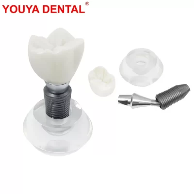 Modelo claro de prótese de implante dentário, dentes de cristal, estrutura Typodont para ensino, estudando prática, treinamento