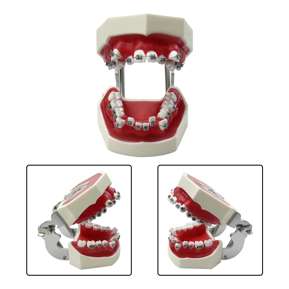 Modelo dental com suporte ortodôntico removível modelo de ensino dental tipodonte com cera vermelha para estudo de ensino de pacientes dentistas