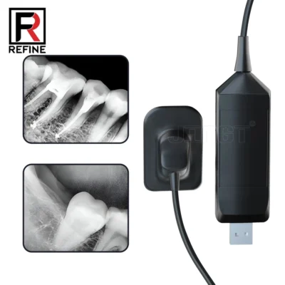 Refine sensor de raio x dental radiovisógrafo rx digital claro equipamentos de radiografias dentárias imagem hd sistema digital intraoral