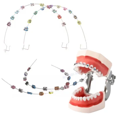 1 par dental falso chaves moda colorido temporária dentes decoração cinta suportes de metal arco fios ligadura ortodôntica laços
