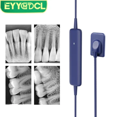 Eyy sensor dental hd unidade de raio x de alta frequência sistema de scanner de imagem dental raio x filmagem equipamento de sensor intraoral digital
