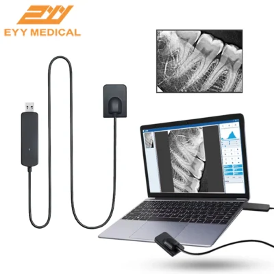 Eyy sensor dental digital intraoral sensor de raios x hd sistema de imagem dental sensor de varredura de imagem oral radiovisografo com software