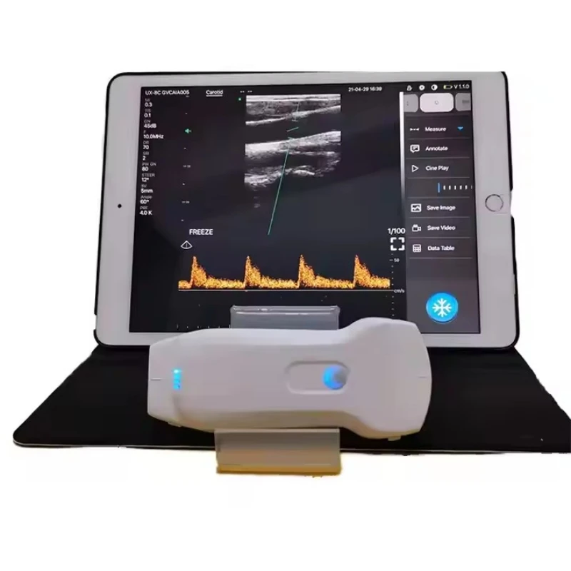 Sonda de ultrassom sem fio portátil colorida e doppler cabeça dupla 3 em 1 conectado Windows/Android/IOS dispositivo WiFi ou USB