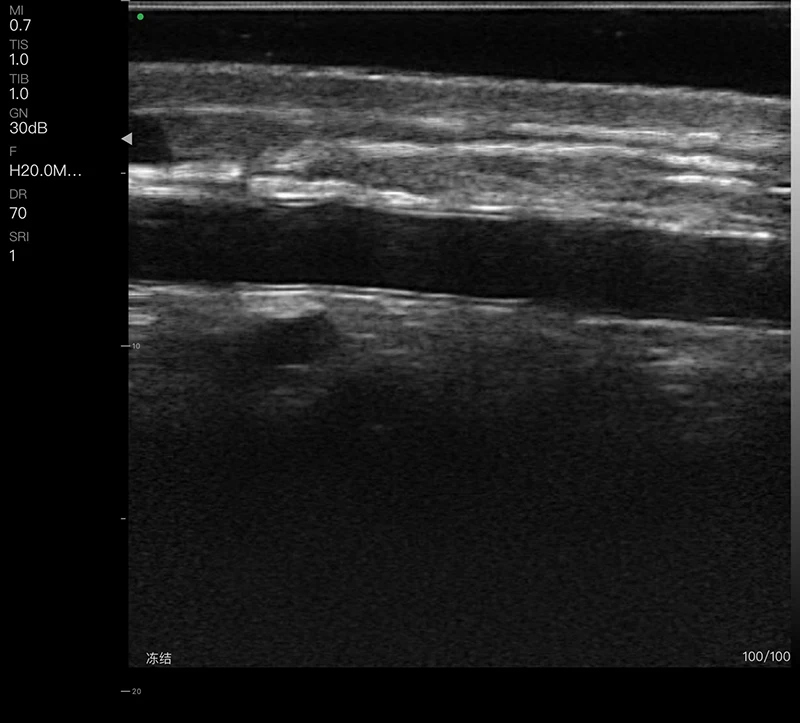 Sonda de Ultrassom Linear Doppler Colorido Sem Fio de Alta Frequência para Estética Facial Médica 192E 18Mhz/24Mhz - Atualização - Image 2