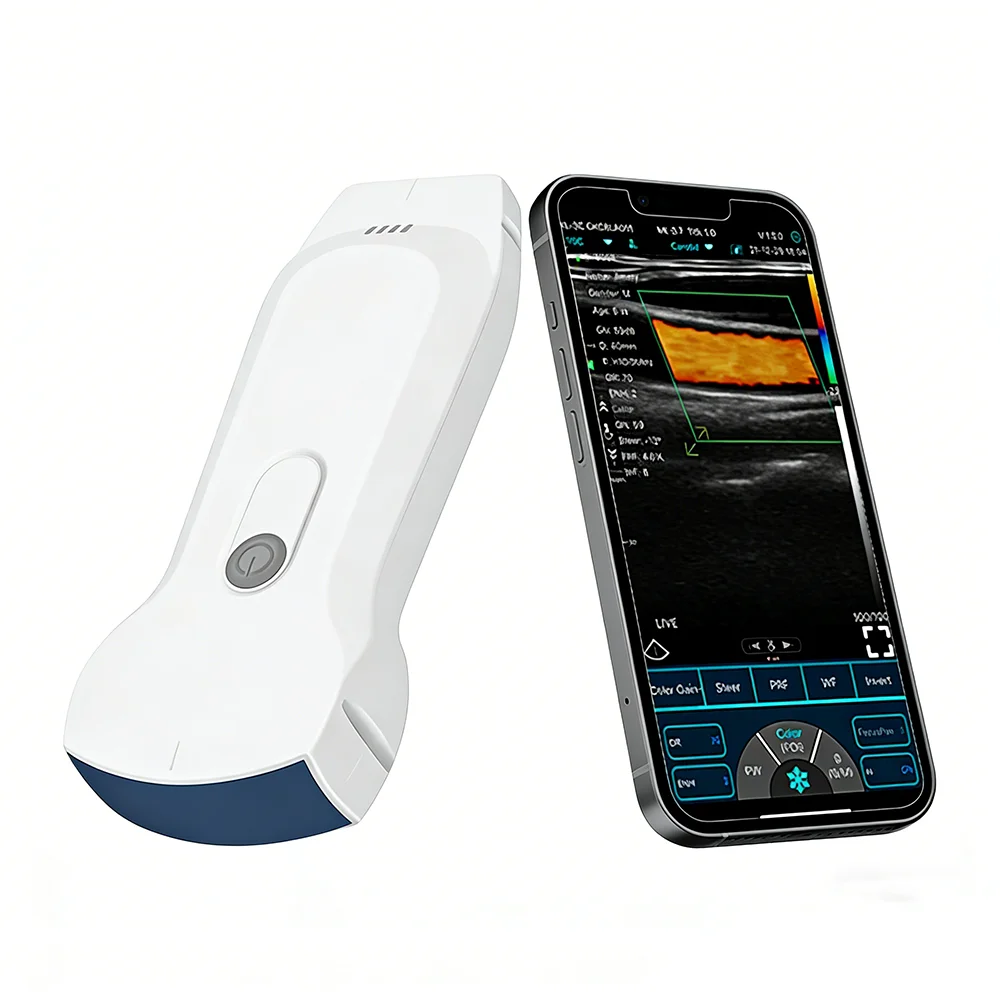 Sonda de Ultrassom 3 em 1 Conectada por WIFI, Scanner Doppler Colorido de 128 Elementos, Compatível com Sistemas Android, iOS e Windows para Animais de Estimação - Image 4