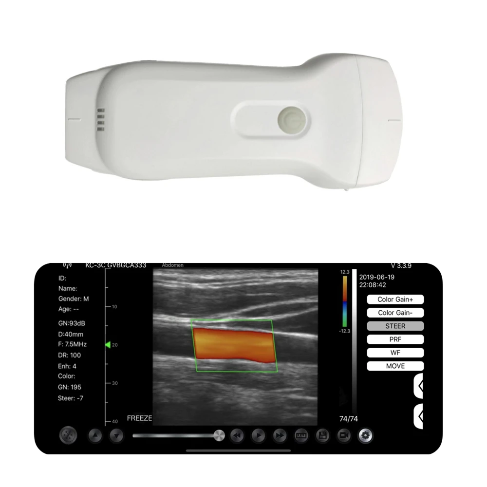 Sonda de ultrassom sem fio portátil colorida e doppler cabeça dupla 3 em 1 conectado Windows/Android/IOS dispositivo WiFi ou USB - Image 2